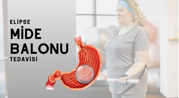 Yutulan Mide Balonu Fiyat