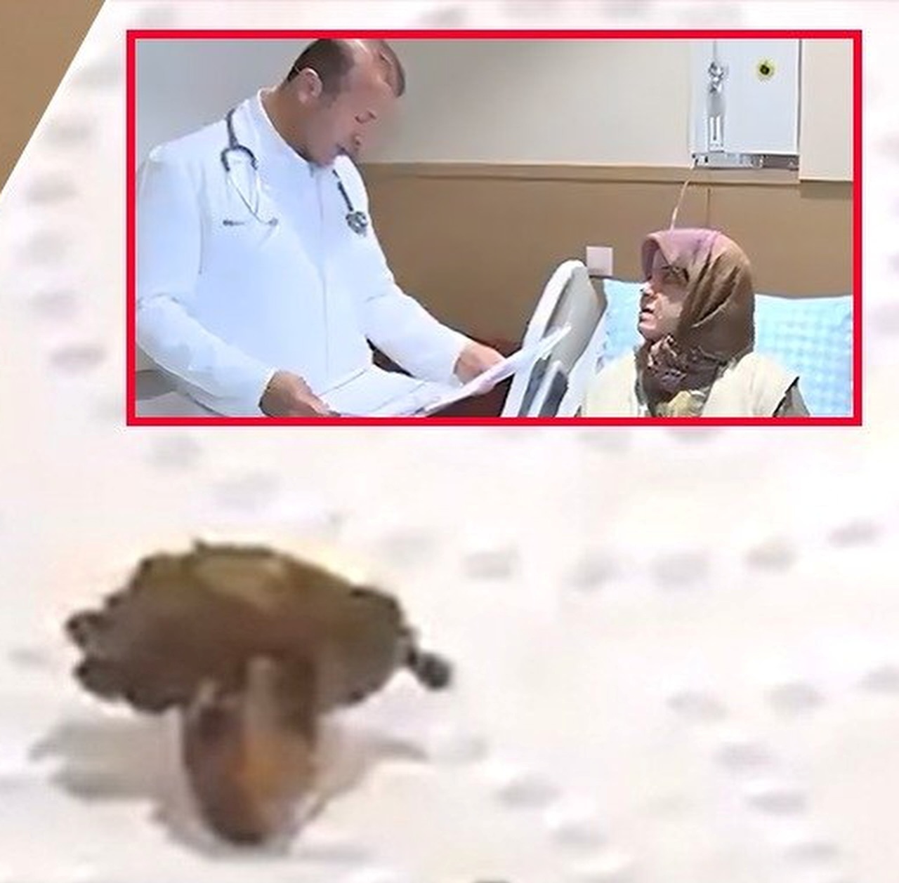 Tıp Literatürüne Geçecek Vaka: 68 Yaşındaki Kadının Akciğerinden Kolonya Tıpası Çıktı - Görsel 2