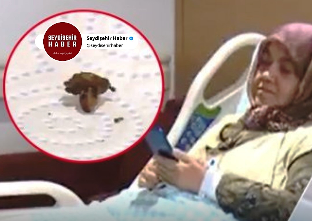 Tıp Literatürüne Geçecek Vaka: 68 Yaşındaki Kadının Akciğerinden Kolonya Tıpası Çıktı - Görsel 3