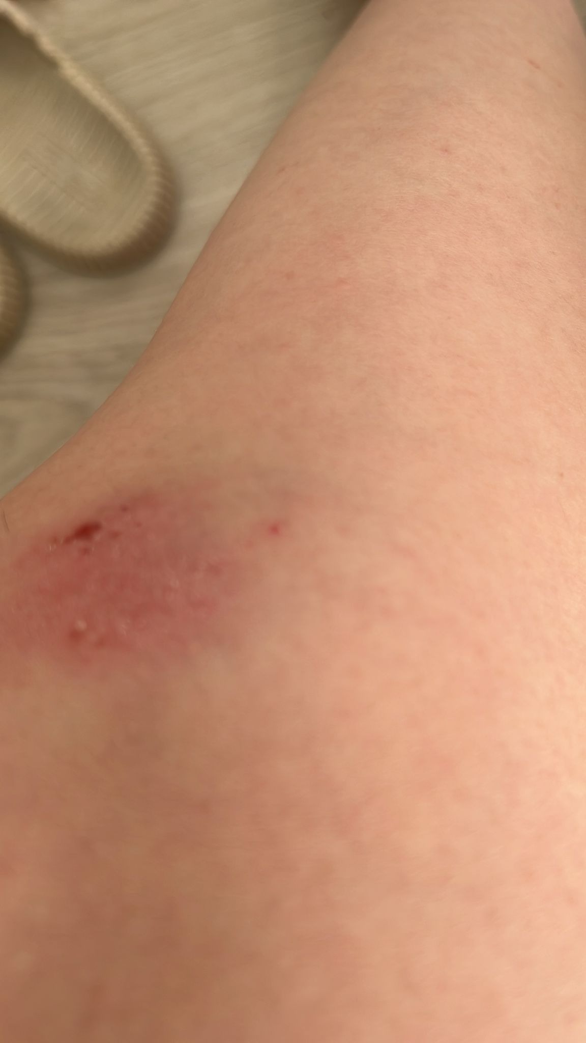 Bursa'da Boğazına bıçak dayadığı kadının 310 lirasını alan gaspçı, sahte sanıp bilezikleri istememiş - Görsel 5