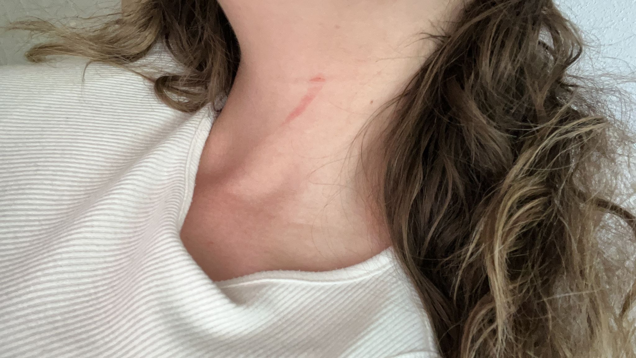 Bursa'da Boğazına bıçak dayadığı kadının 310 lirasını alan gaspçı, sahte sanıp bilezikleri istememiş - Görsel 6