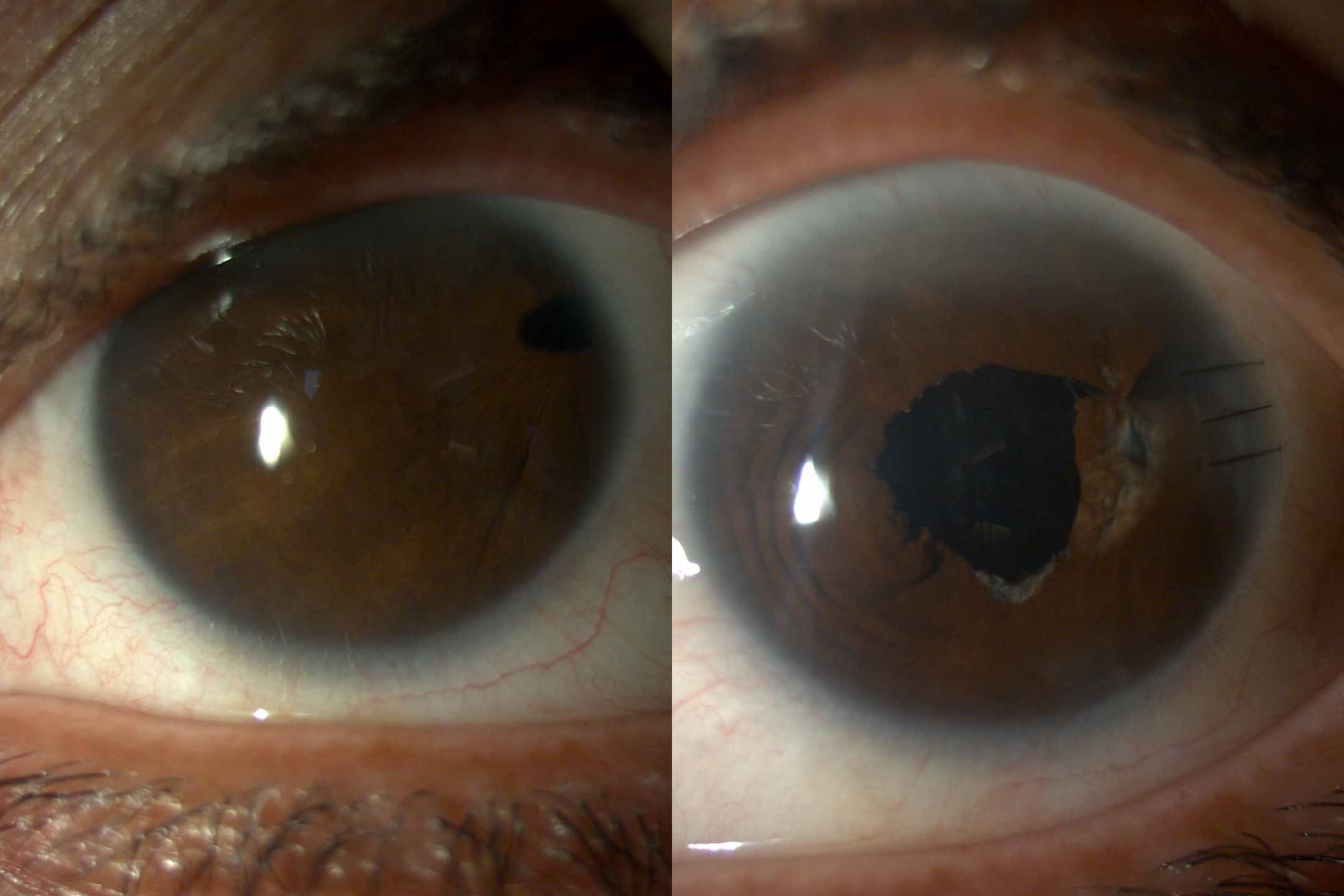 20 yıl sonra net görmeye başladı; 'bana gözümü verdiler' - Görsel 2