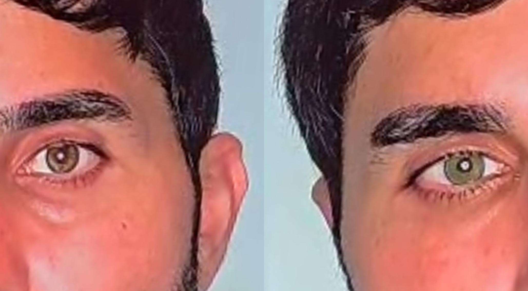 Göz rengini kalıcı olarak değiştirmek mümkün; en çok mavi ve yeşil uygulanıyor - Görsel 3