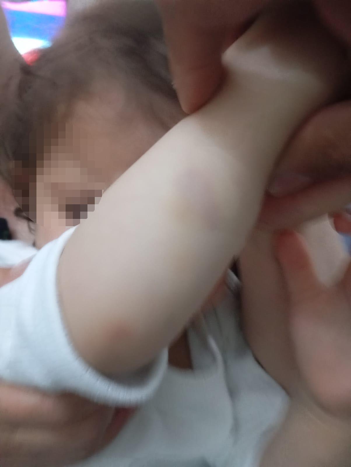 Konya- 1,5 yaşındaki kızını dövdüğü iddia edilen anneye 2 yıla kadar hapis talebi - Görsel 7