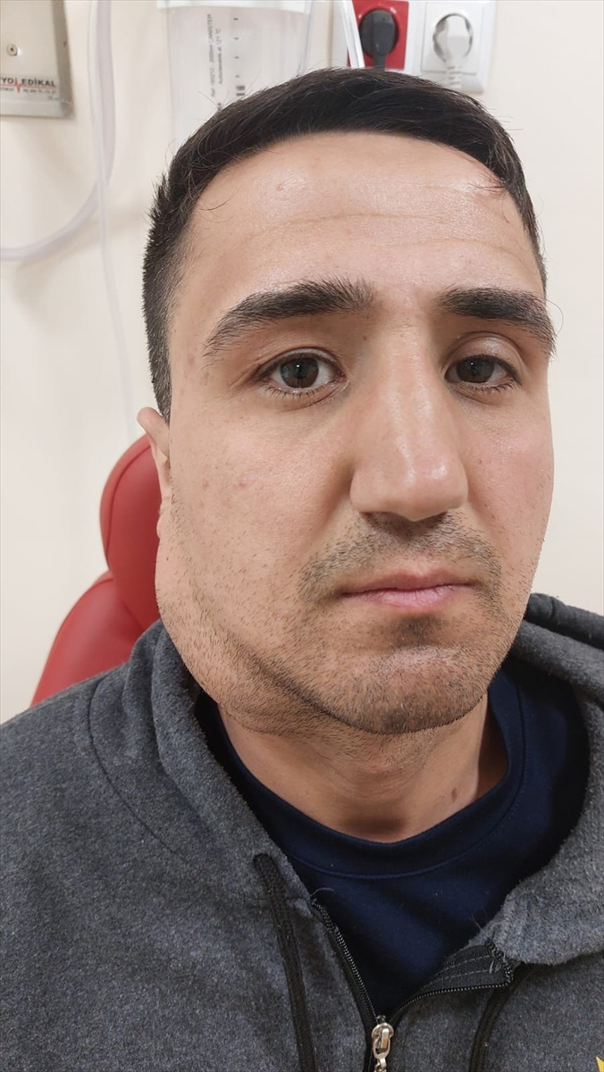 Yüzündeki 15 yıllık tükürük bezi tümöründen 5 saatte kurtuldu - Görsel 4