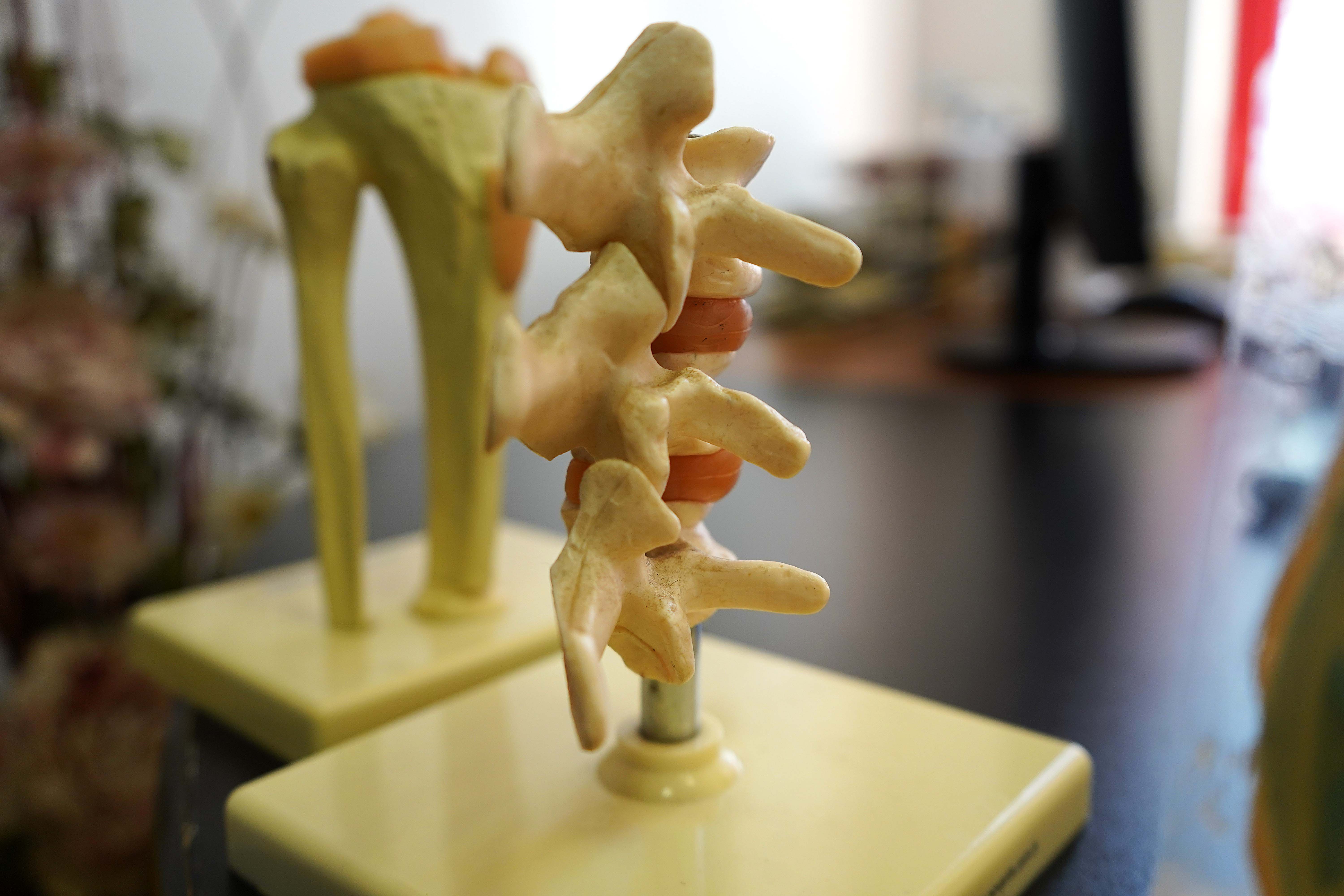 Ağır okul çantaları skolyozu tetikliyor; ağrılar kronikleşiyor - Görsel 4