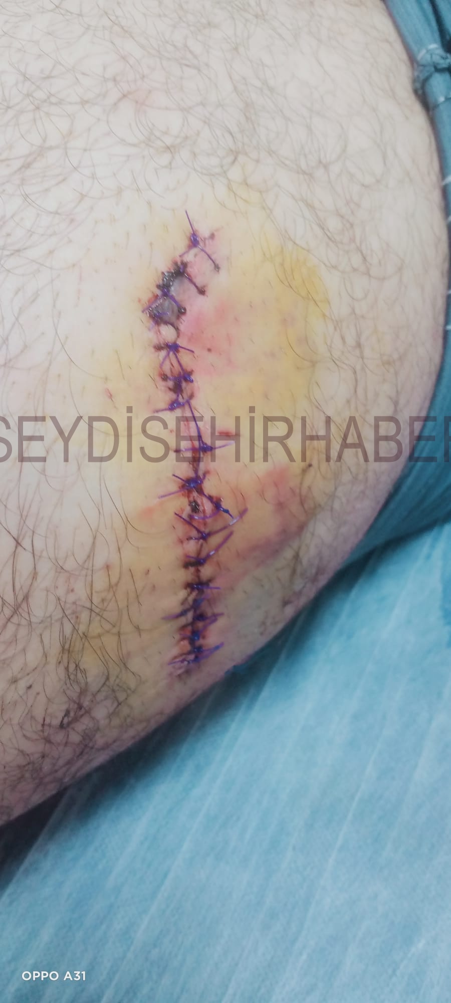 Konya'da Akran Şiddeti: 11 Sınıf  öğrencisi  Osman Bıçaklanarak Yaralandı - Görsel 1