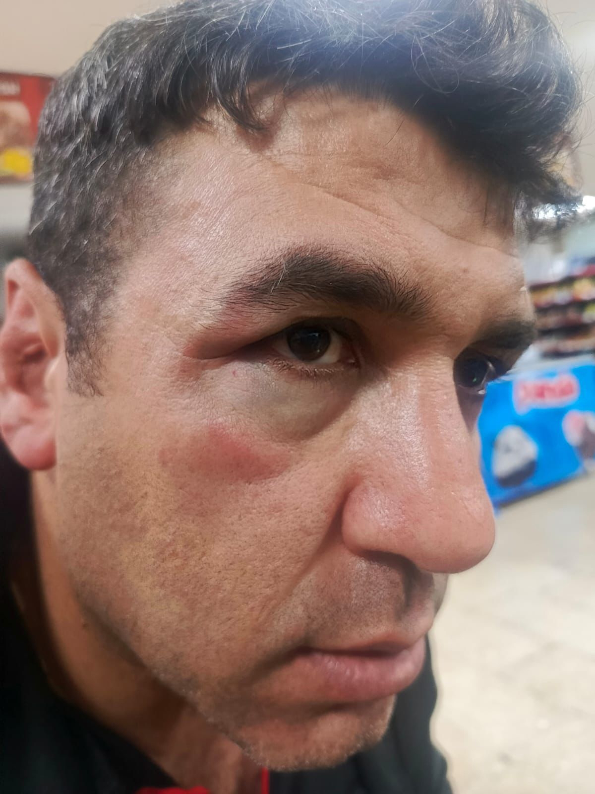 Konya'da amatör ligde kavga: 5 yaralı - Görsel 9