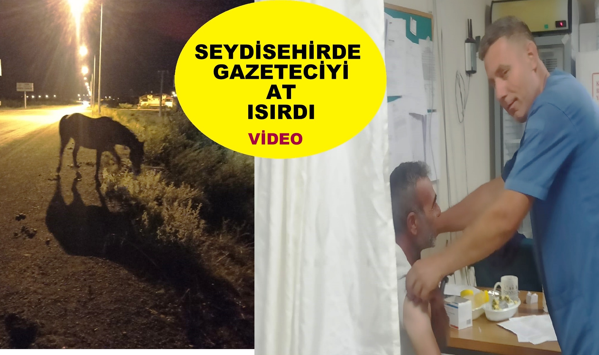 Seydişehir'de  Gazeteci İsmail Sünbülü At ısırdı